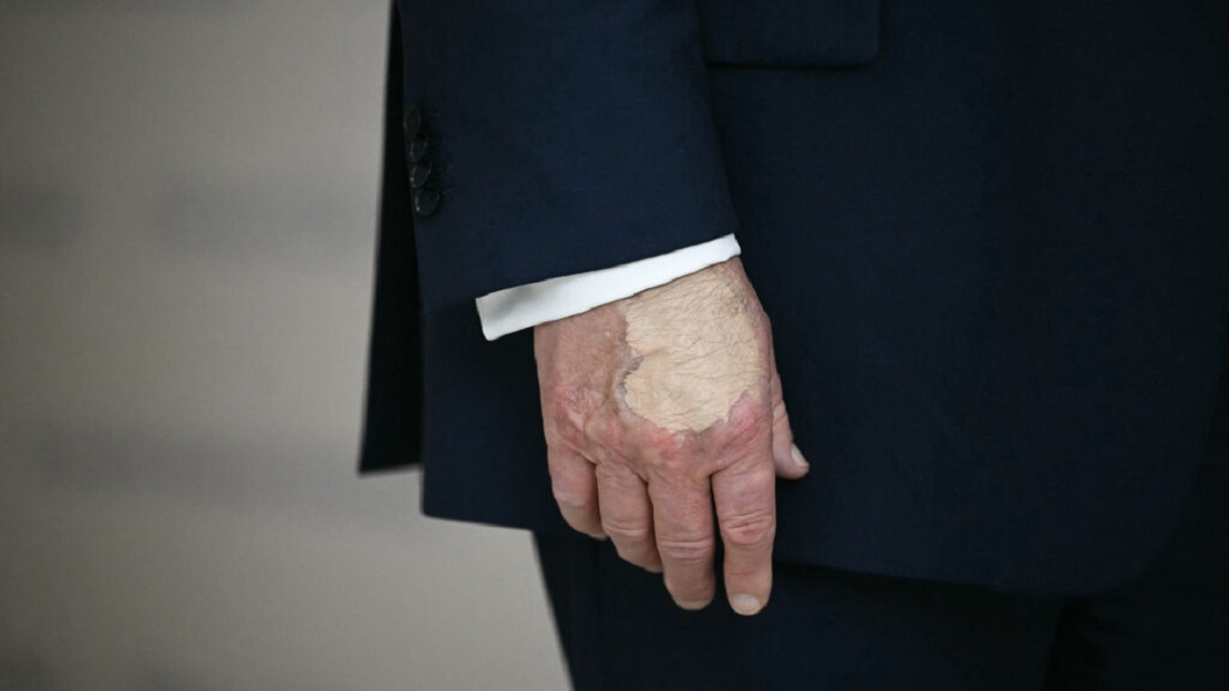 ترامب يتباهى بـ