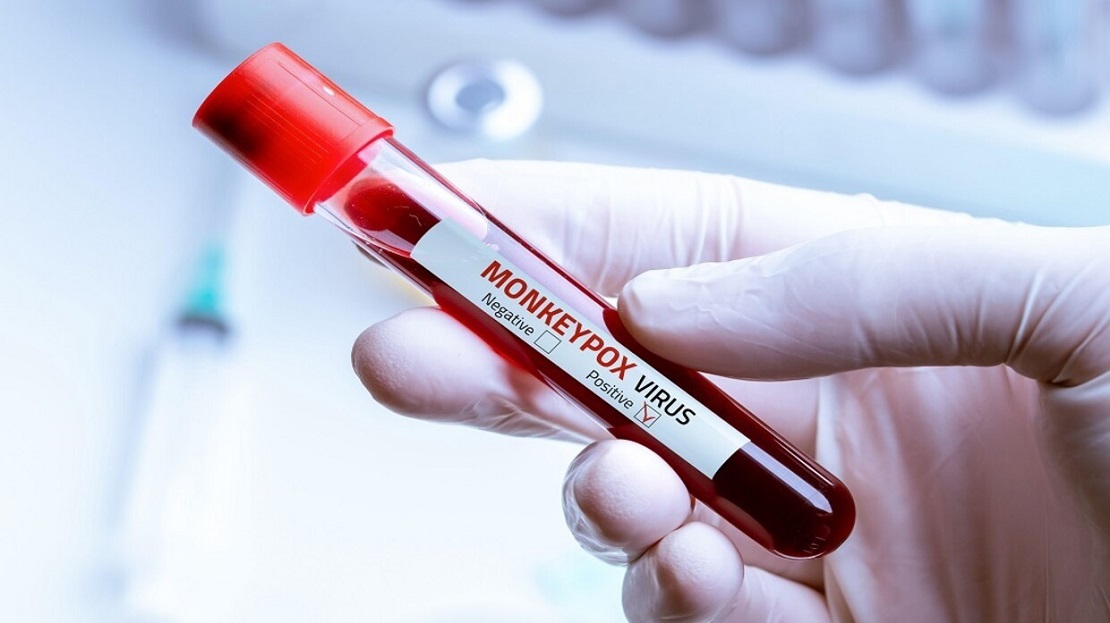 Egyptian Health warns a specific group of people about the "monkeypox" virus