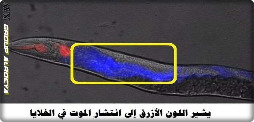 هكذا ينتشر الموت في جسم الإنسان، فيديو